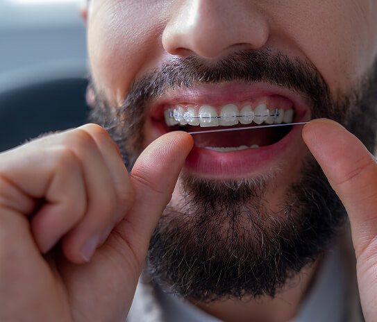 a man with braces flossing